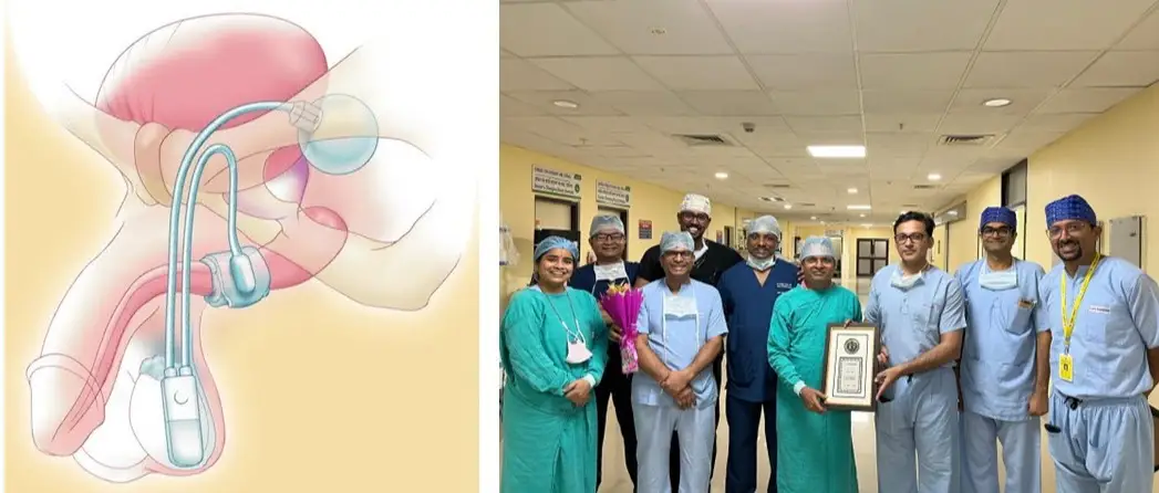 AIIMS Bhubaneswar Launches Advanced Artificial Urinary Sphincter(AUS) Implantation Service